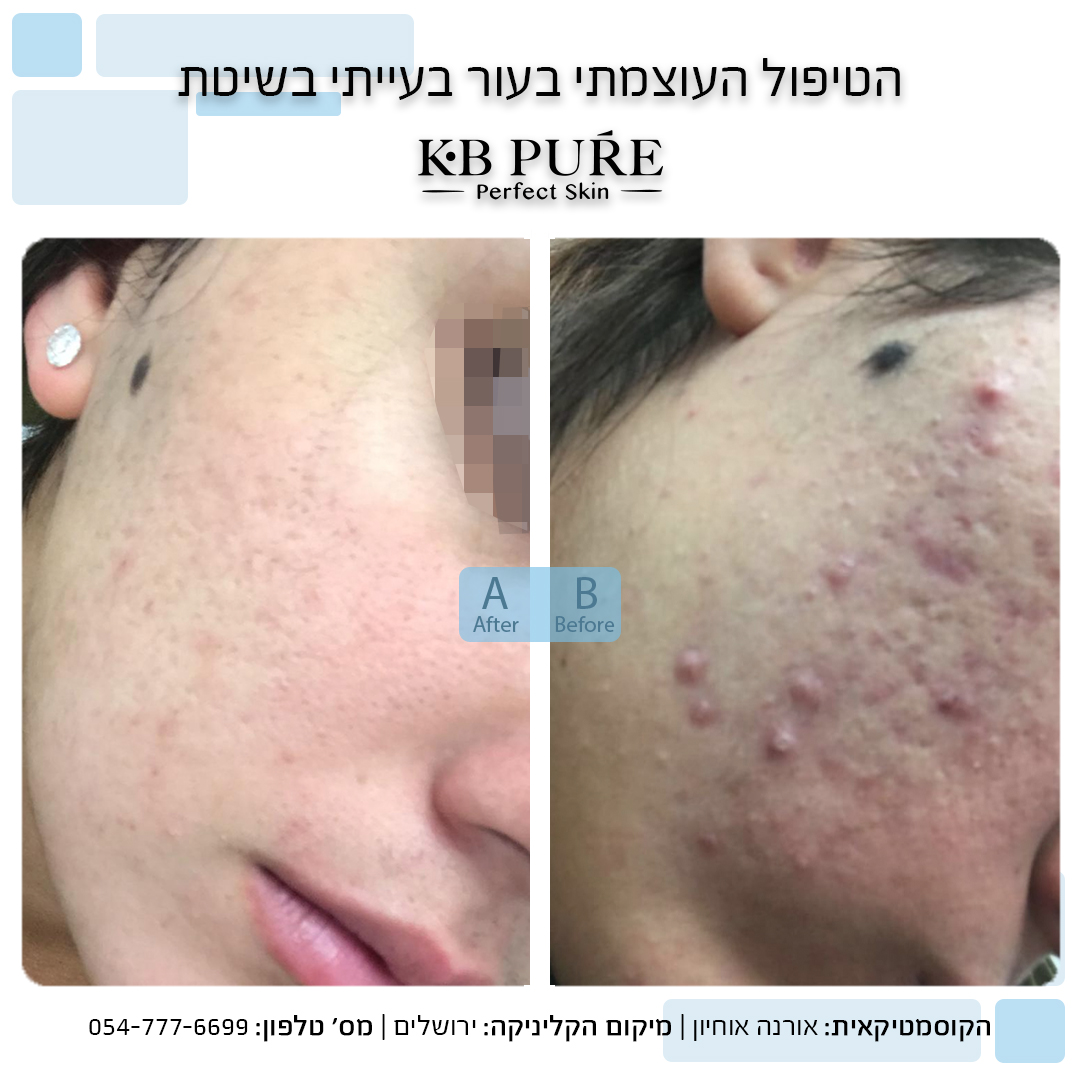 אורנה אוחיון ירושלים
