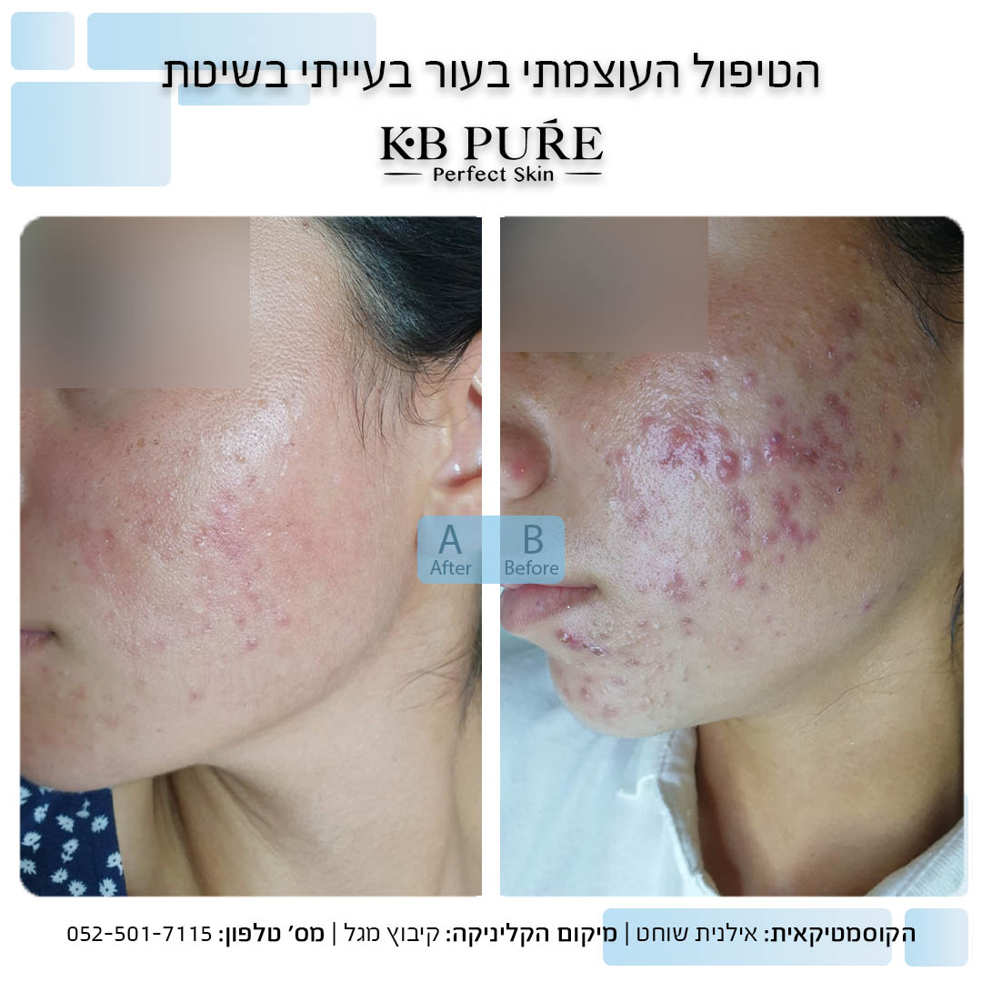 אילנית שוחט מגל (1)