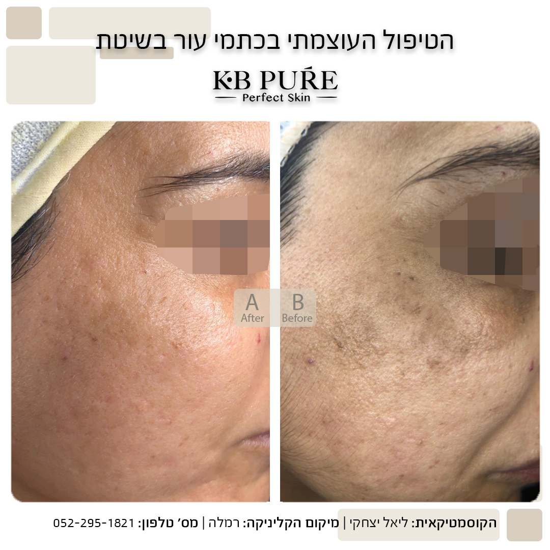 ליאל יצחקי רמלה 2