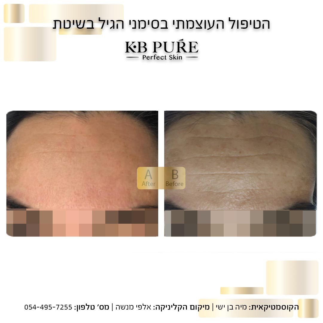 מיה בן ישי אלפי מנשה (3) - לפני ואחרי