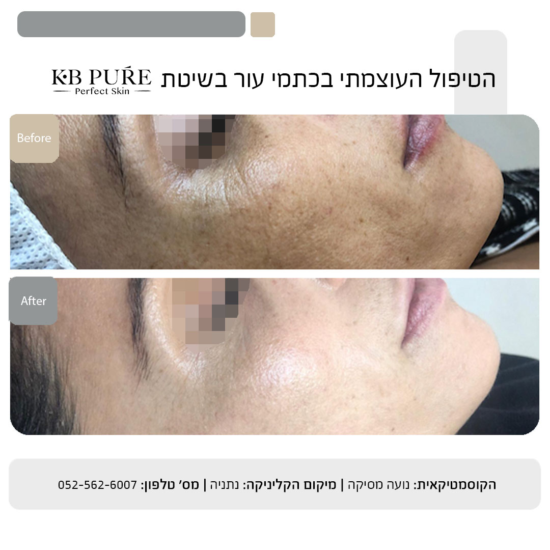 נועה מסיקה