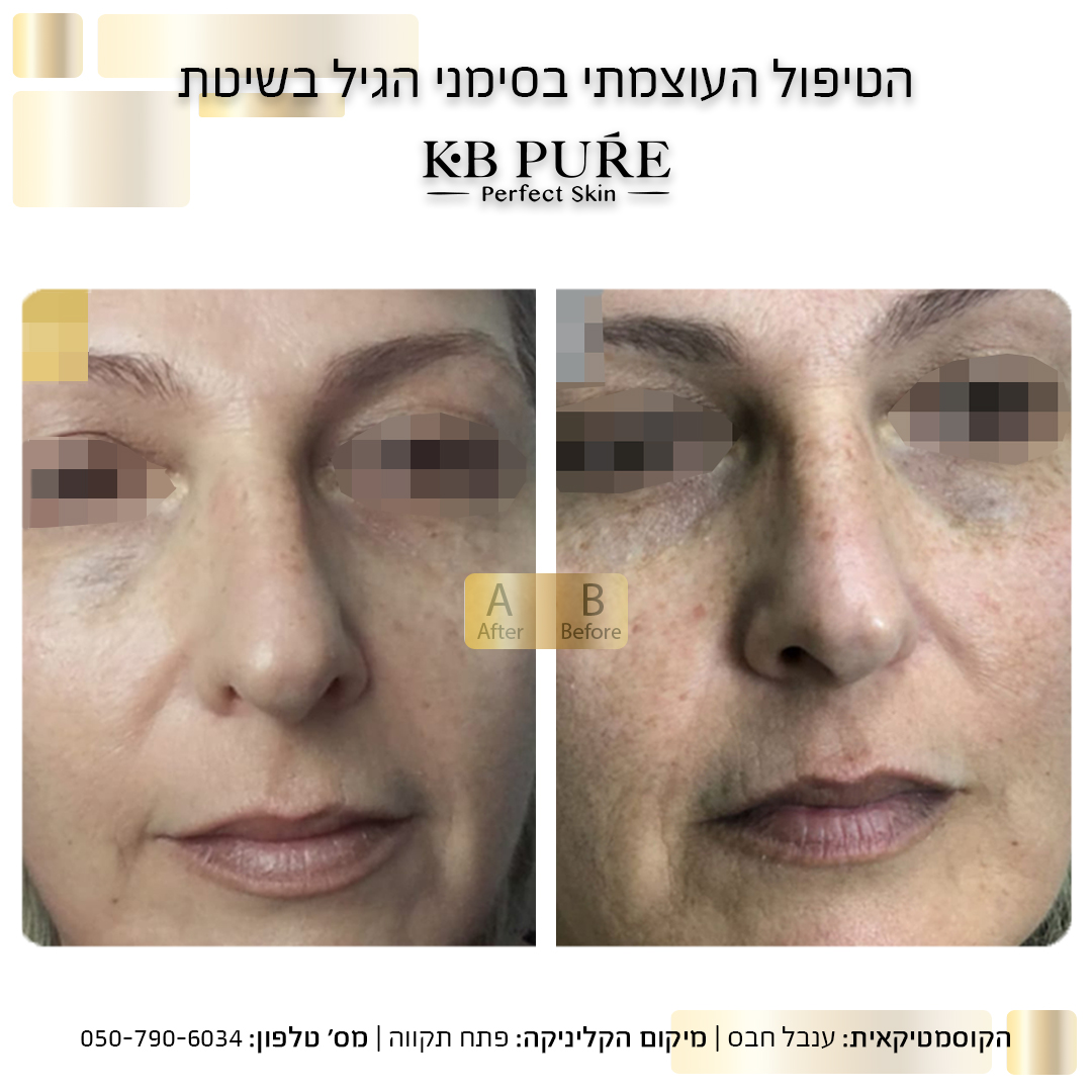 ענבל חבס פתח תקווה 2
