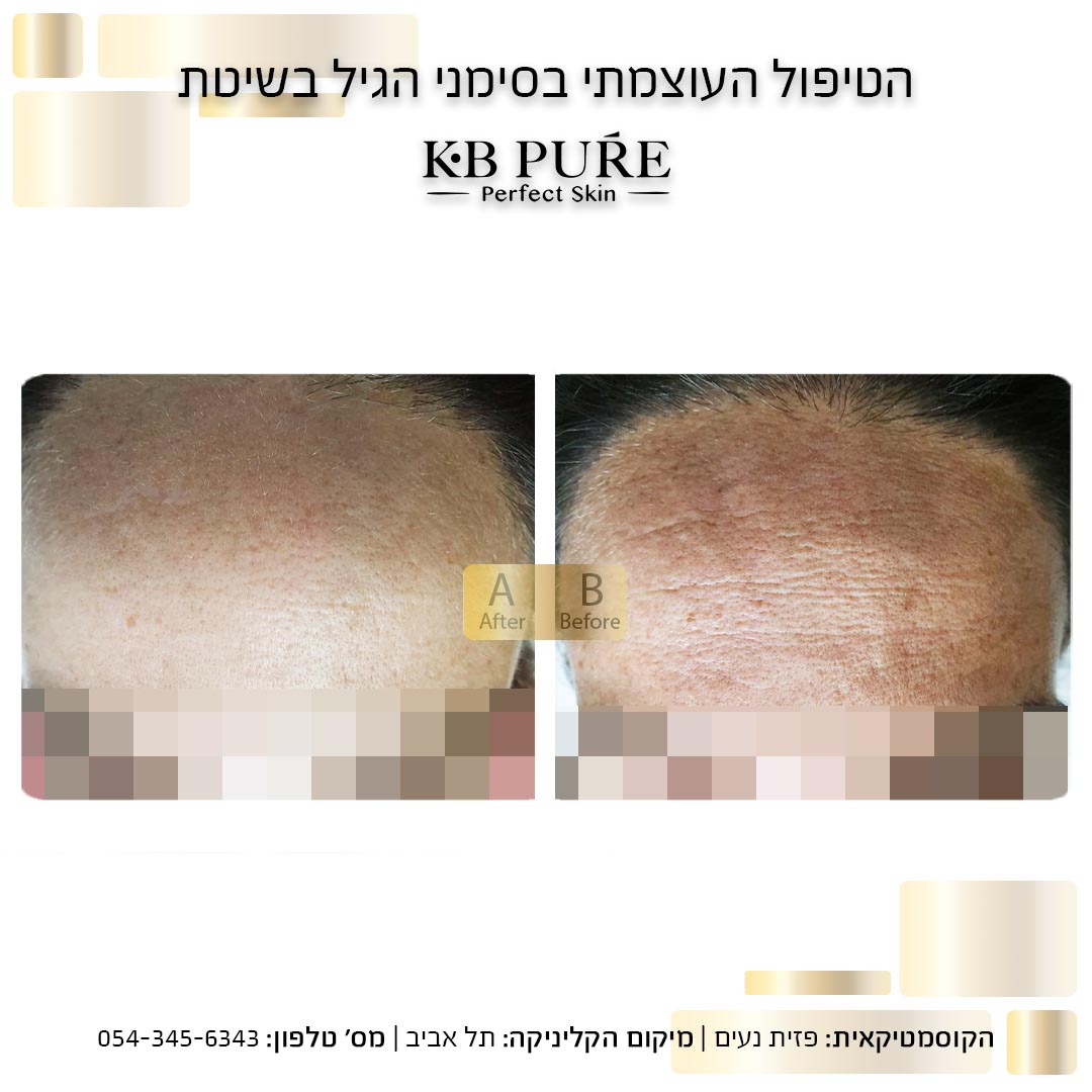 פזית נעים תל אביב