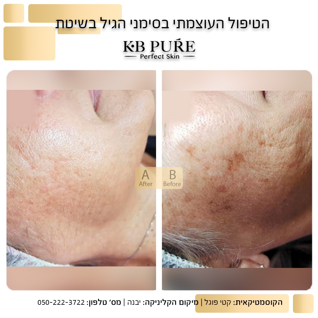 קטי פוגל יבנה
