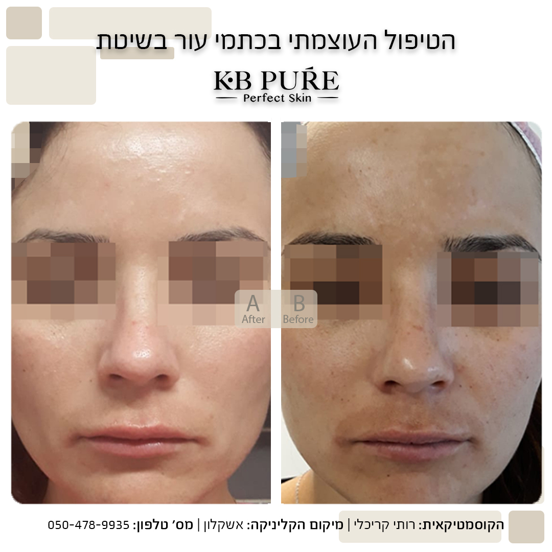 רותי קריכלי אשקלון (1)