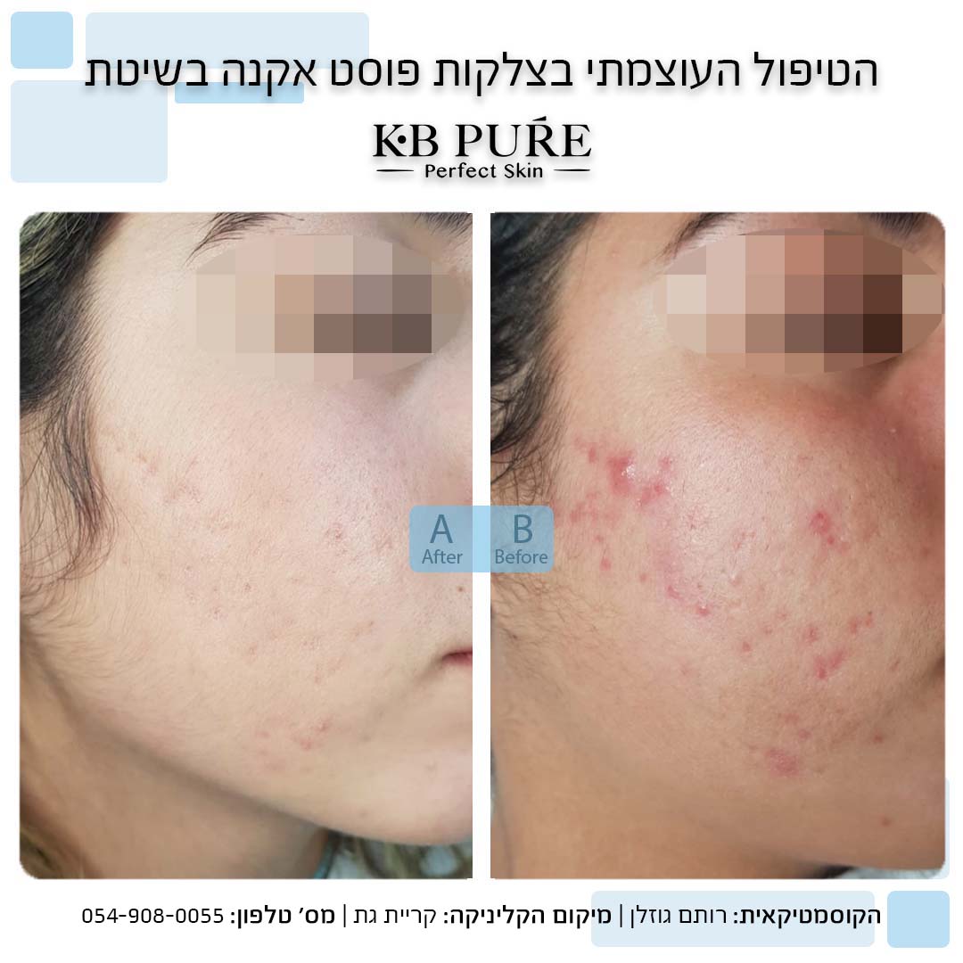 רותם גוזלן קריית גת 2