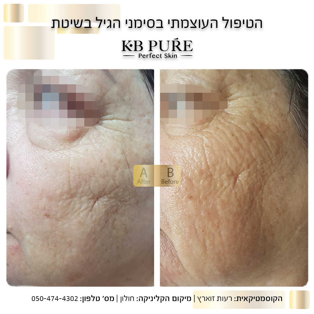 רעות זוארת חולון