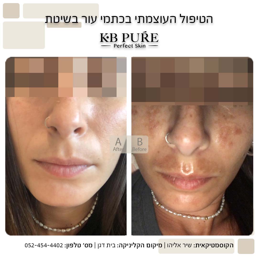 שיר אליהו בית דגן 4