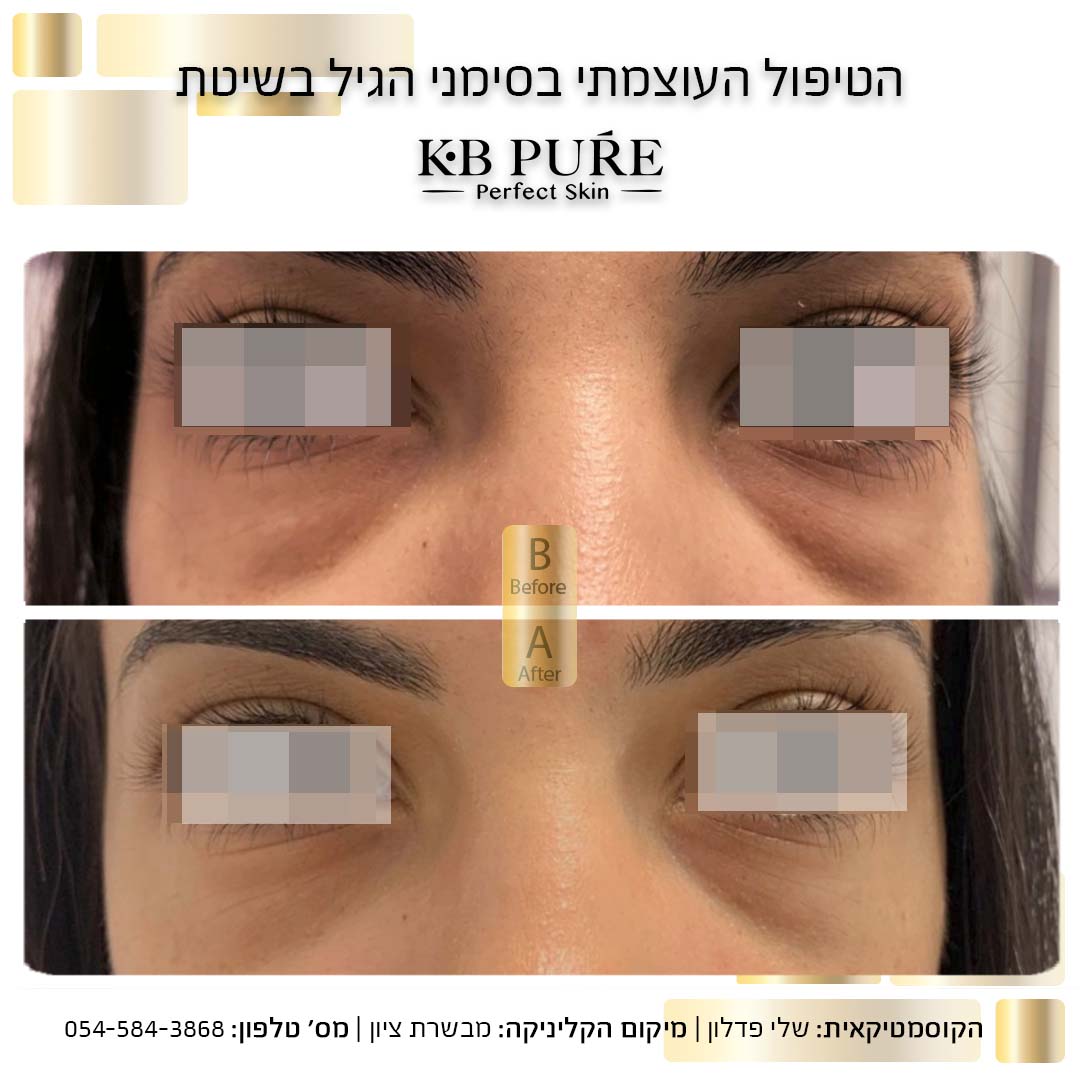 שלי פדלון מבשרת ציון 2