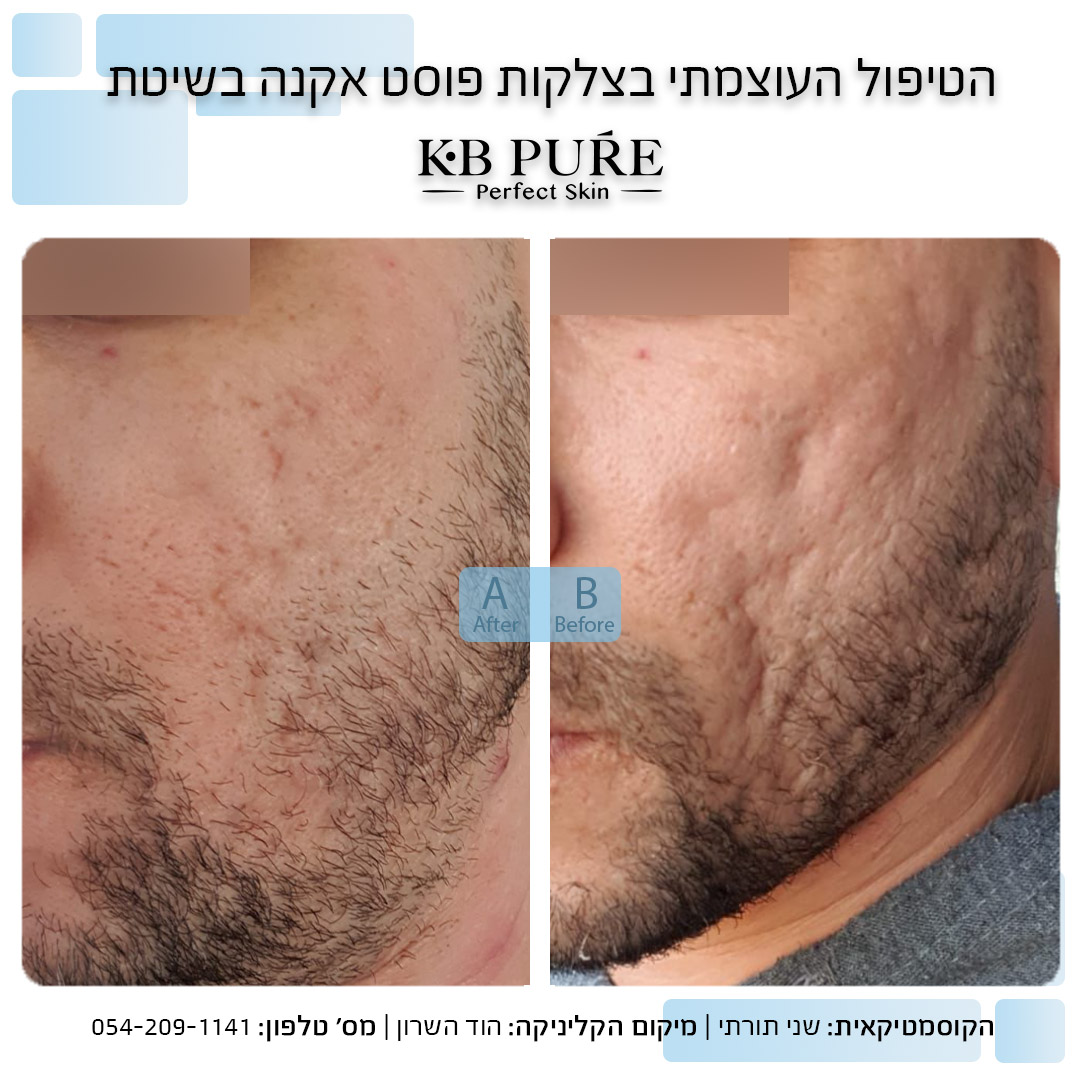 שני תורתי הוד השרון 3