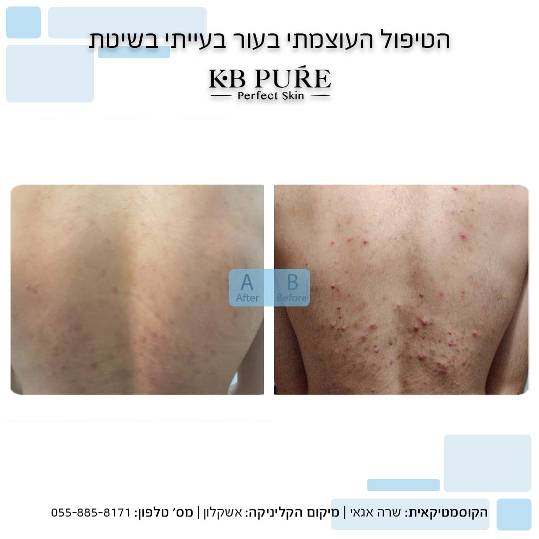 שרה אגאי אשקלון
