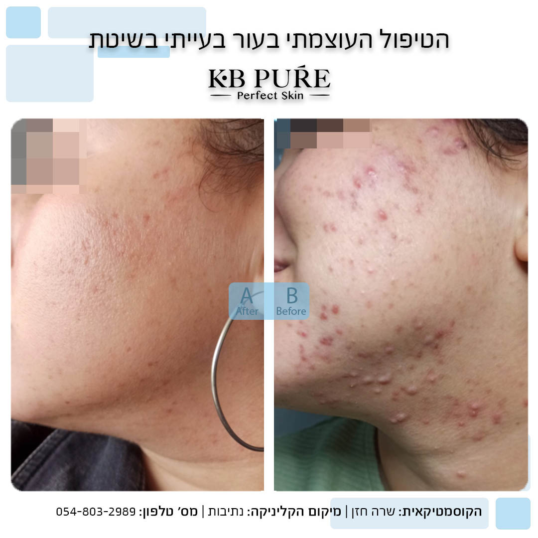 שרה חזן נתיבות (10)
