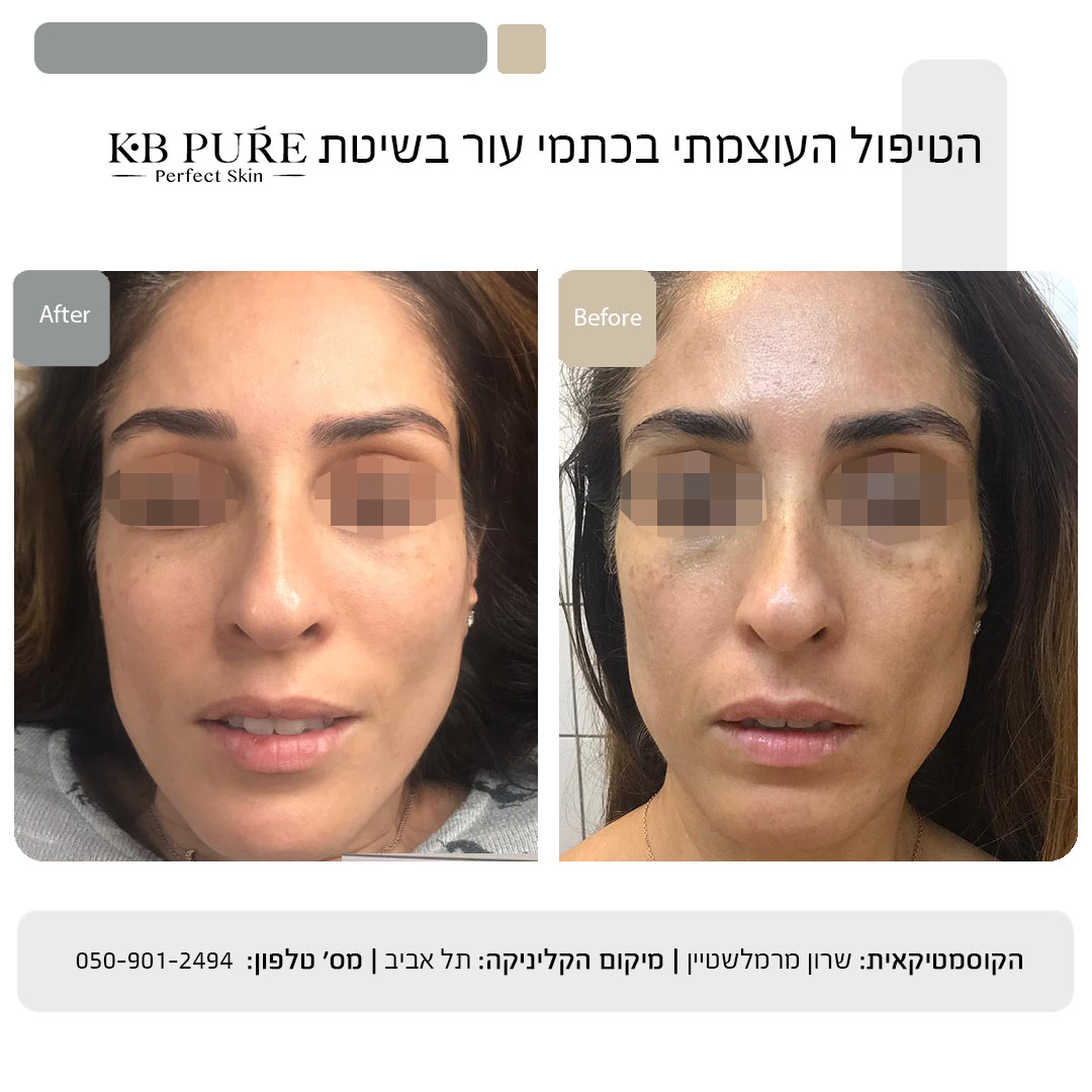 שרון מרמלשטיין (1)