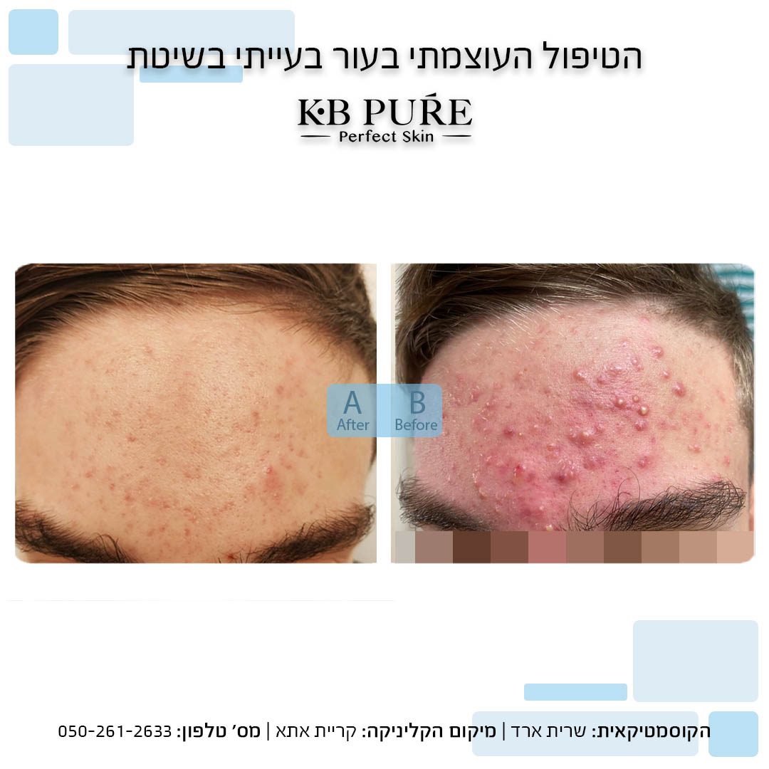 שרית ארד קריית אתא 4
