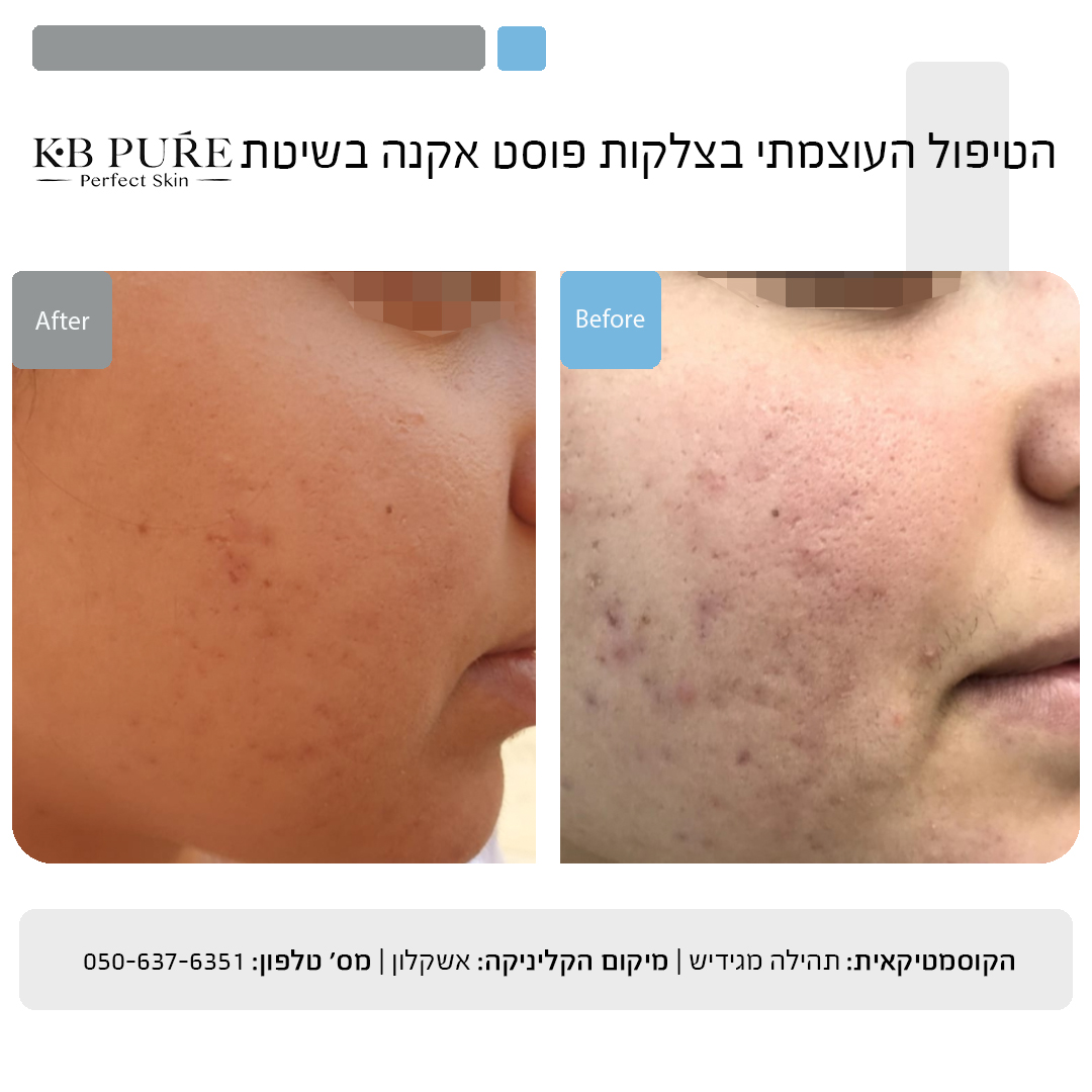 תהילה מגידיש אשקלון 5