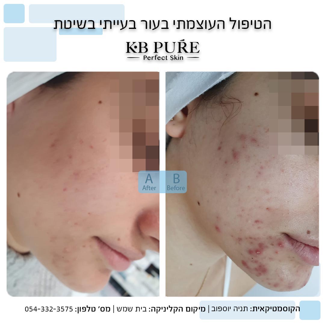 תניה יוספוב בית שמש 9 copy