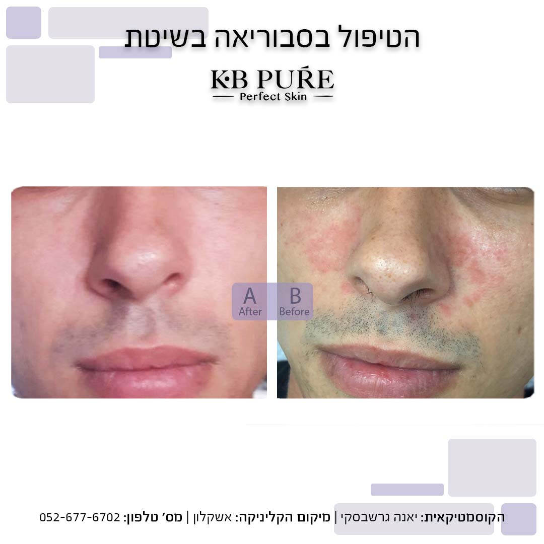 יאנה גרושבסקי אשקלון (2) - לפני ואחרי