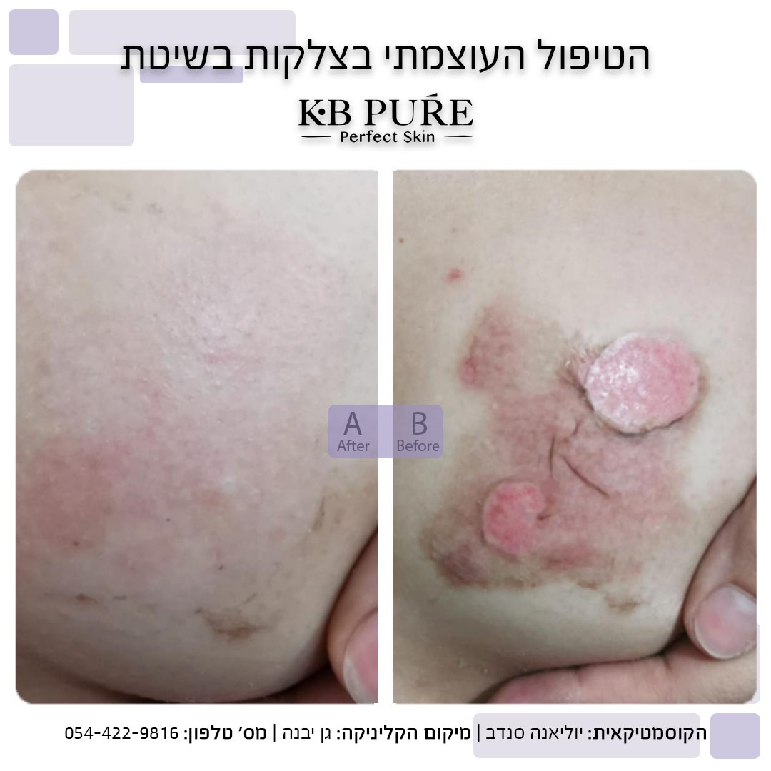 יוליאנה סנדב גן יבנה - לפני ואחרי