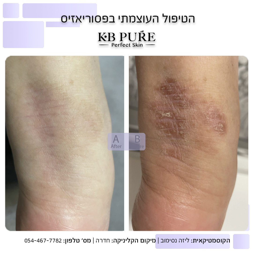 ליזה נסימוב חדרה 2