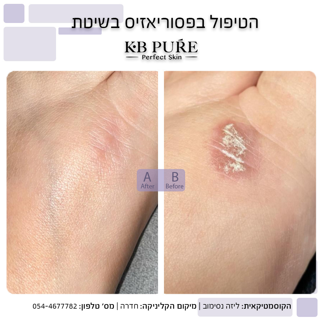 ליזה נסימוב חדרה