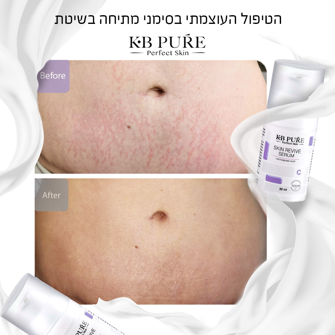 לפני ואחרי 13 2