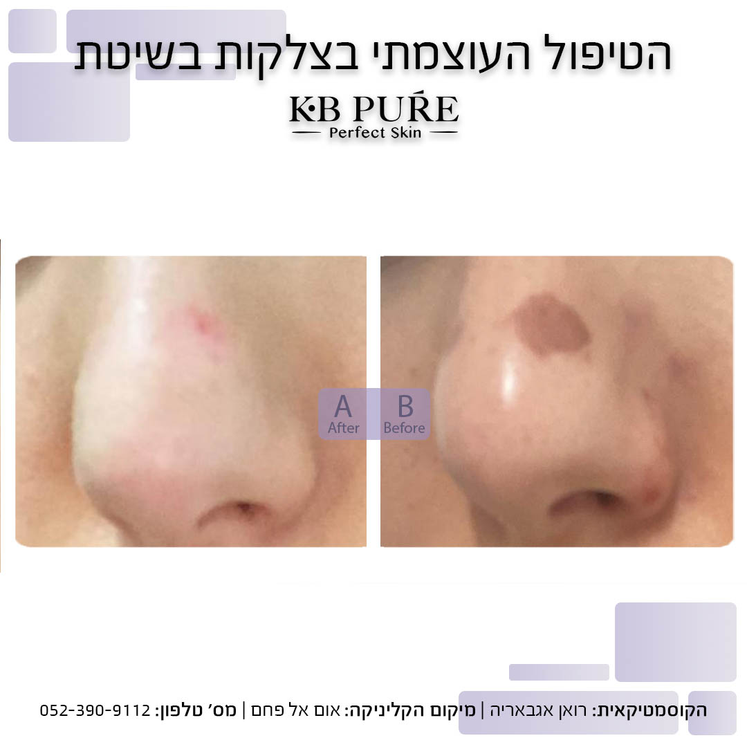 רואן אגבאריה אום אל פחם 2 (1)