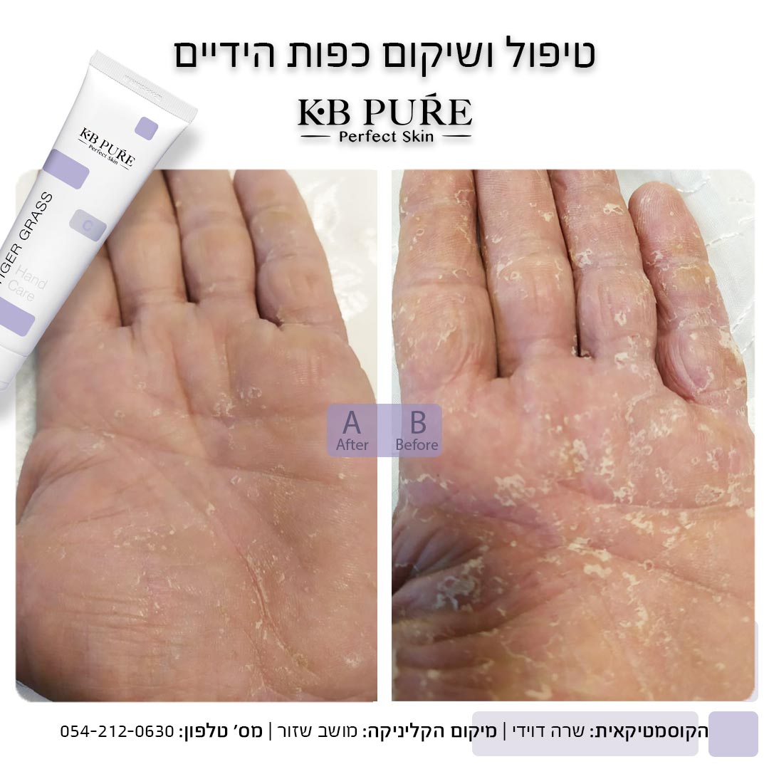 שרה דוידי שזור - לפני ואחרי
